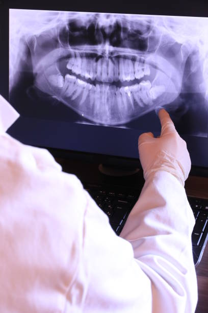 Best Emergency Treatment for Dental Infections or Abscesses in Brunswick, MD